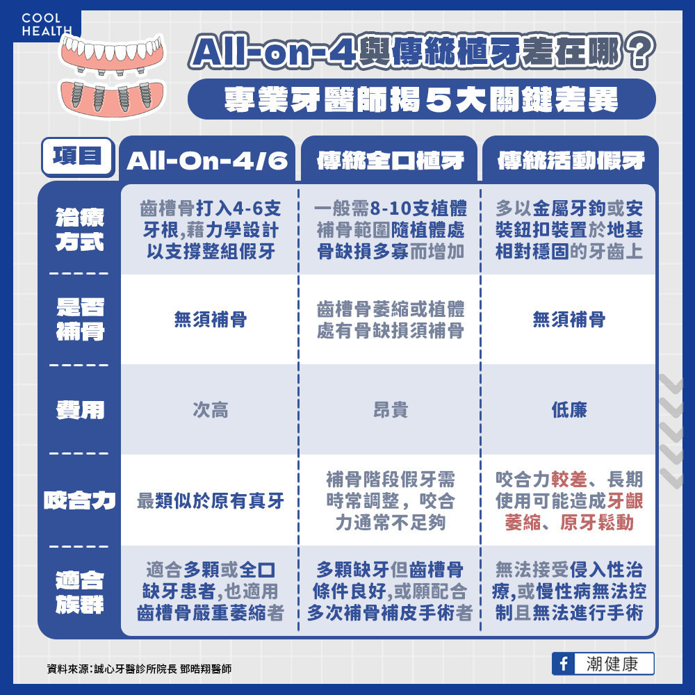 鄧醫師專訪｜All on 4 全口重建與傳統植牙差別？