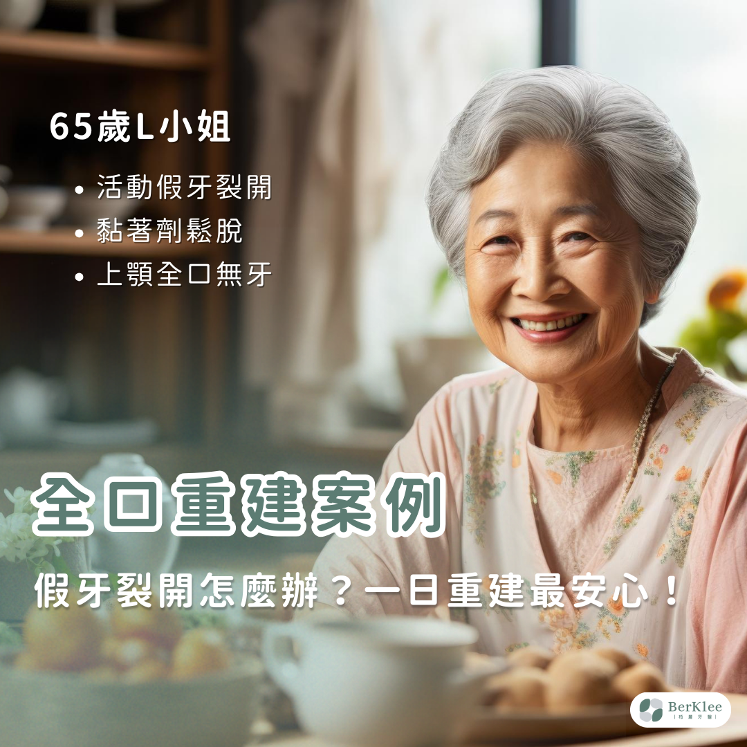 桃園全口重建案例－65歲L小姐因活動假牙脫落，希望做一日全口牙齒重建！