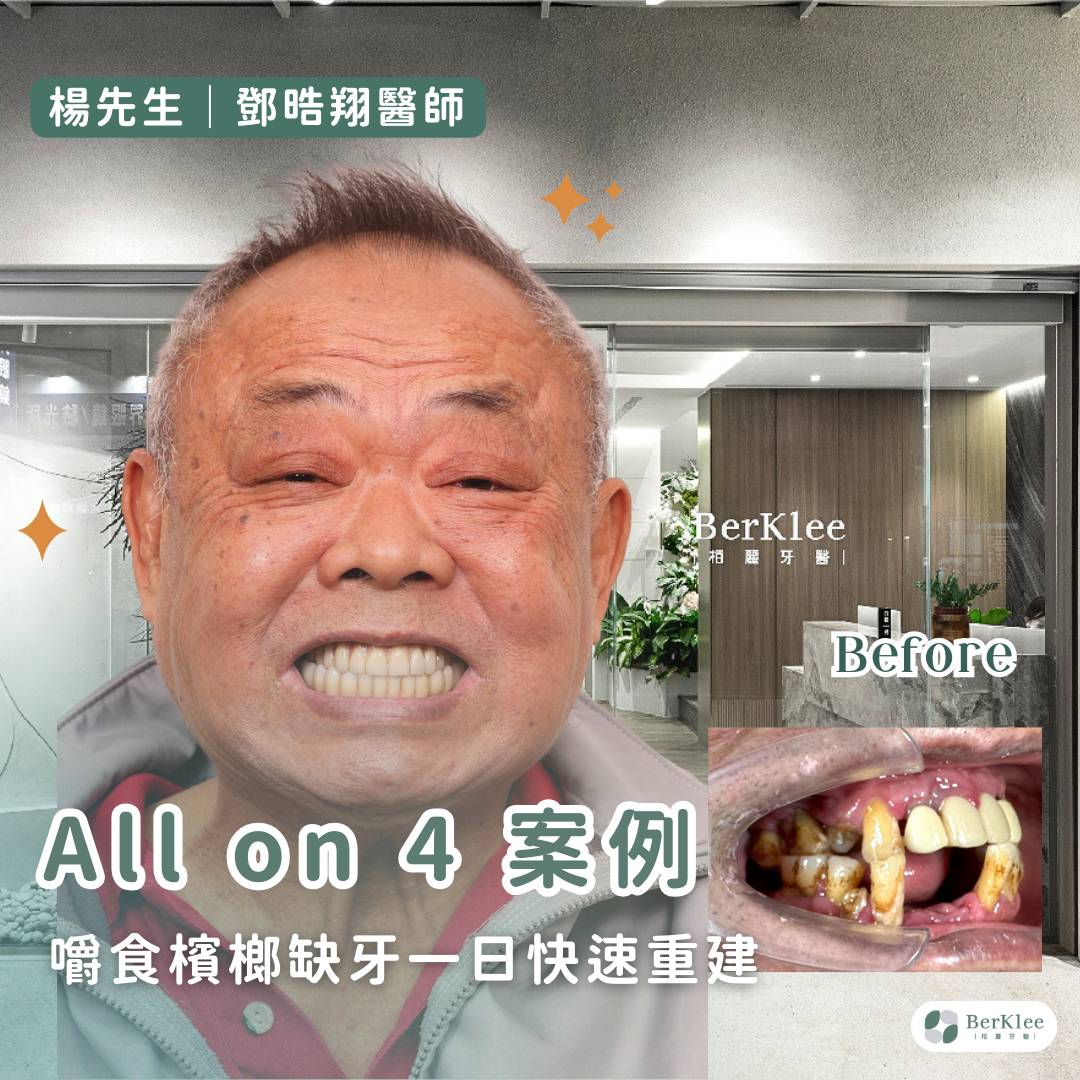 桃園 All on 4 全口重建植牙案例－助楊先生解決吃檳榔牙齒缺失泛黃問題，一日快速獲得好牙！