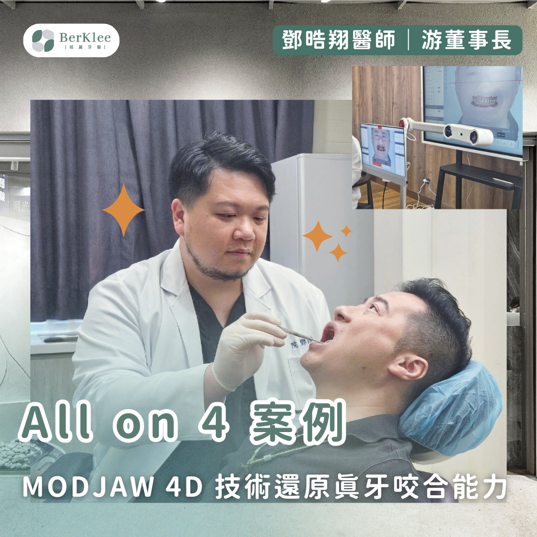 桃園 All on 4 全口重建案例－ MODJAW 4D 數位下顎動態分析，為游董打造更高效率的植牙療程！