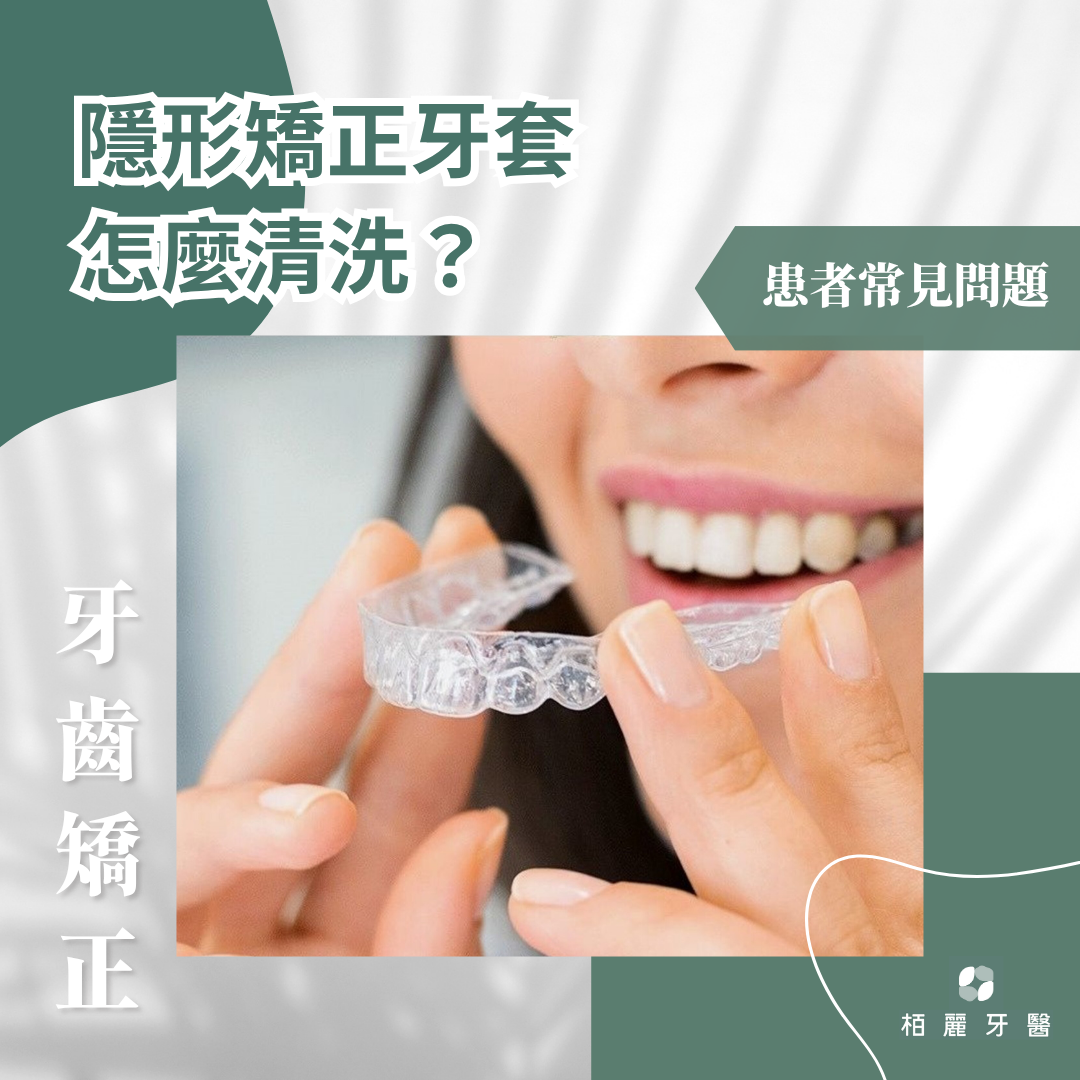 隱形矯正術後牙套怎麼清洗？矯正患者實際分享飲食、配戴術後經驗