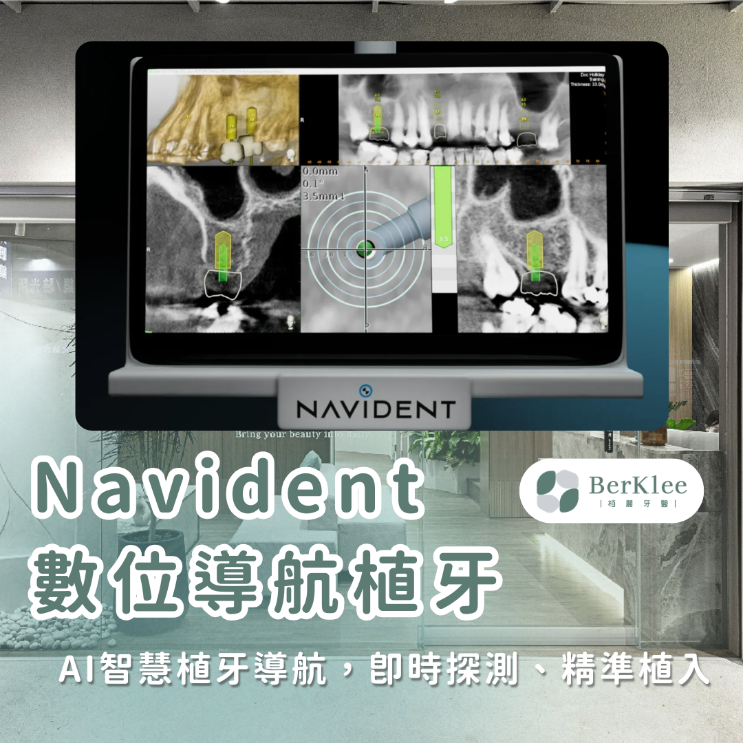 桃園植牙推薦｜Navident 數位導航植牙，GPS 級精準定位，手術更穩更安心！